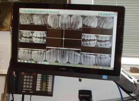 Bear Naked Technologies Dental x-ray on office computer screen